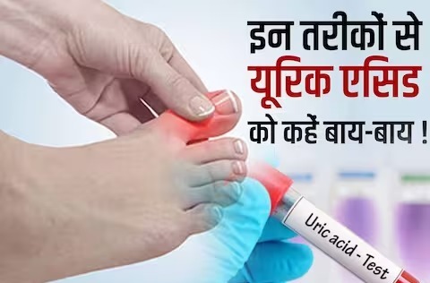 health tips :- बिना दवा के यूरिक एसिड हो जाएगा क्लीन , सिर्फ 5 बातों का रखें ध्यान