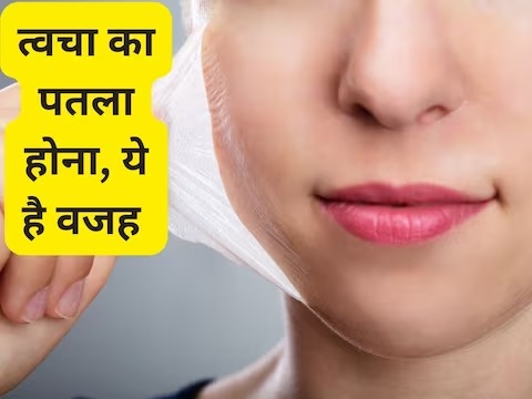 Skin Thinning: क्या बढ़ती उम्र के साथ-साथ त्वचा भी पतली होने लगती है?जानें एक्सपर्ट से स्किन थिनिंग 